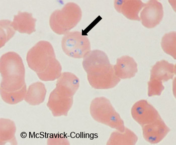 Babesia in blood smear