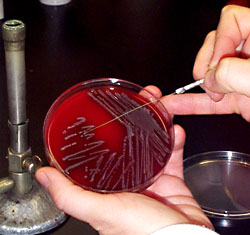 Bacterial inoculum