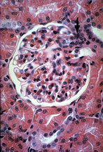 renalcorpuscle