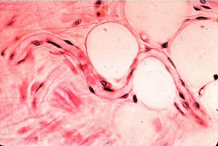 capillary epithelium