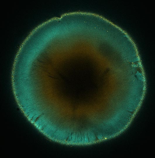 Mouse eye magnified